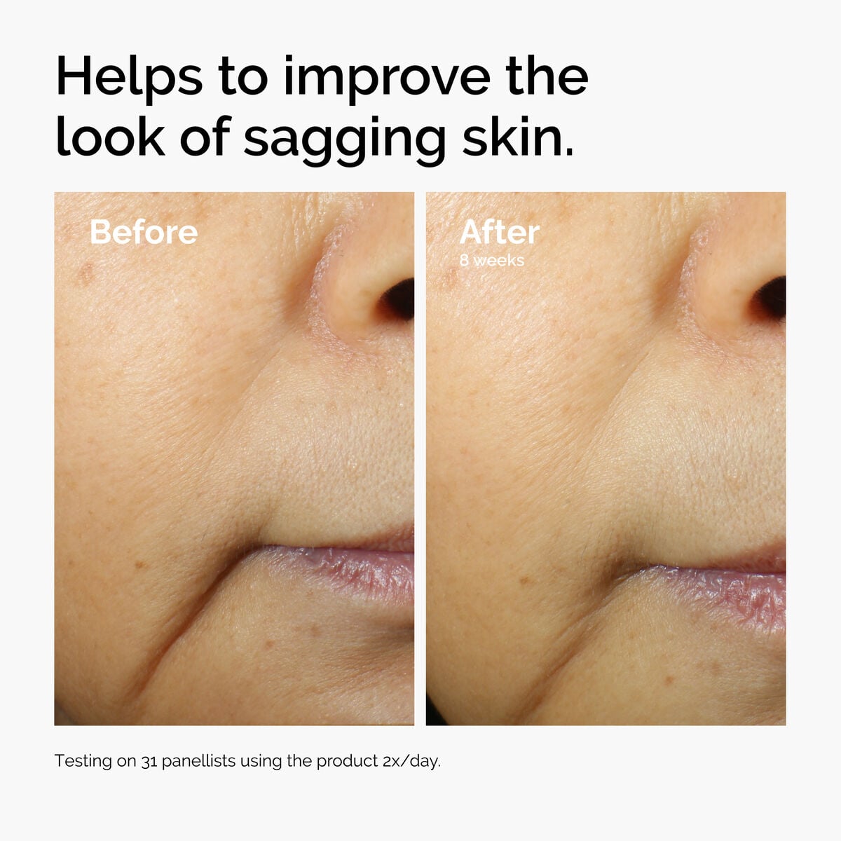 caffeine-3-escin-1-face-serum-r6 ord-caffeine-3pct-escin-1pct-face-serum-before-after-sagging.jpg