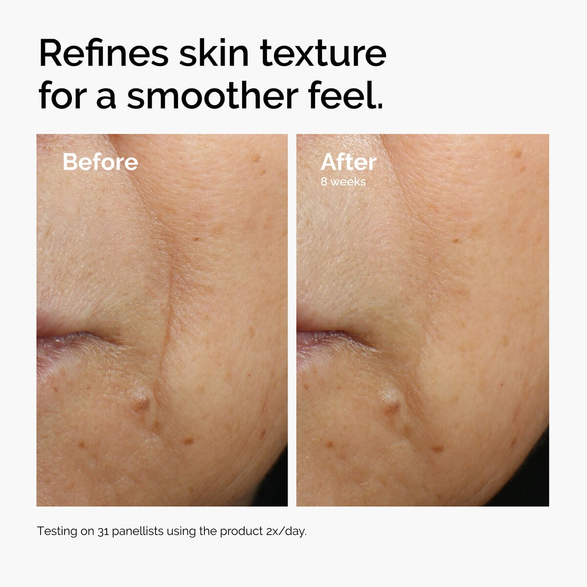 caffeine-3-escin-1-face-serum-r6 ord-caffeine-3pct-escin-1pct-face-serum-before-after-texture.jpg