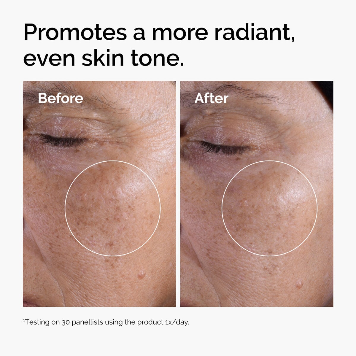 glycolic-acid-7-exfoliating-toner-a7 ord-glycolic-before-after-radiance.jpg