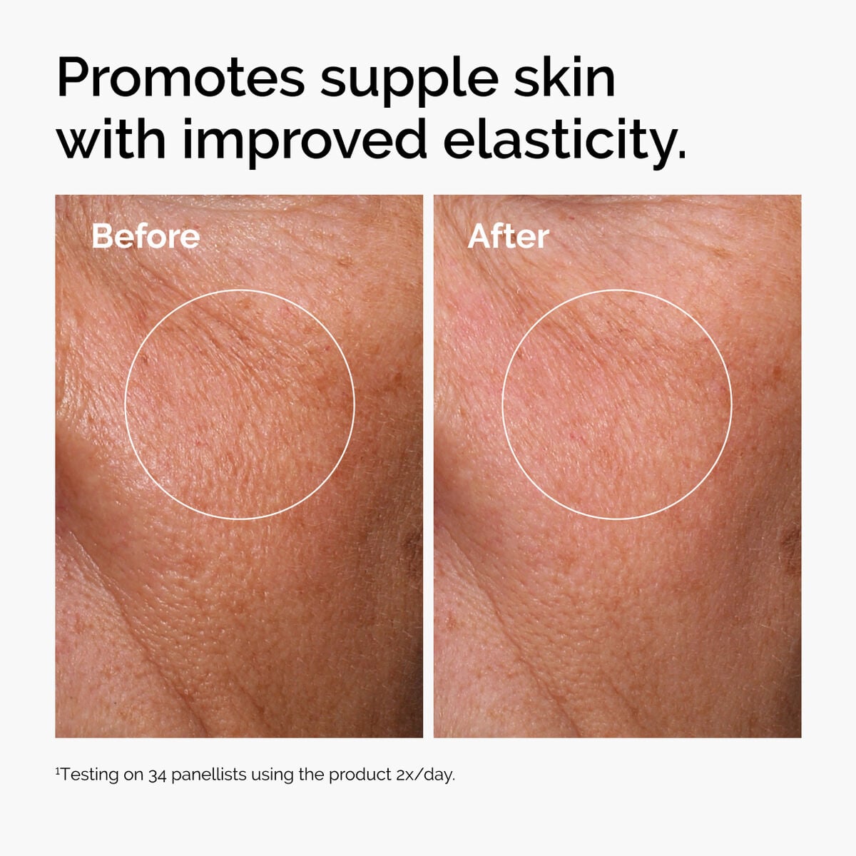 hyaluronic-acid-2-b5-with-ceramides-v2 ord-hyaluronic-acid-2pct-b5-hydrating-serum-before-after-elasticity.jpg