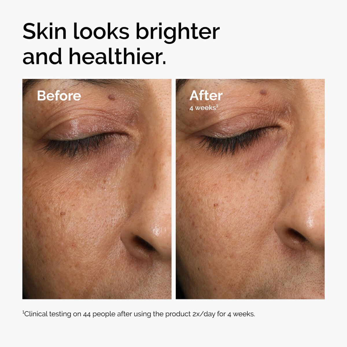 multi-antioxidant-radiance-serum-k0 ord-mars-before-after-healthy.jpg