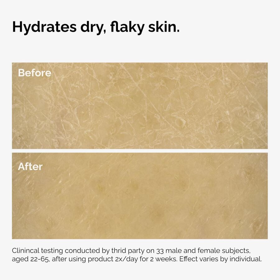 the-body-care-collection-d3 ord-natural-moisturizing-factors-inulin-body-before-after-graphic-02.jpg