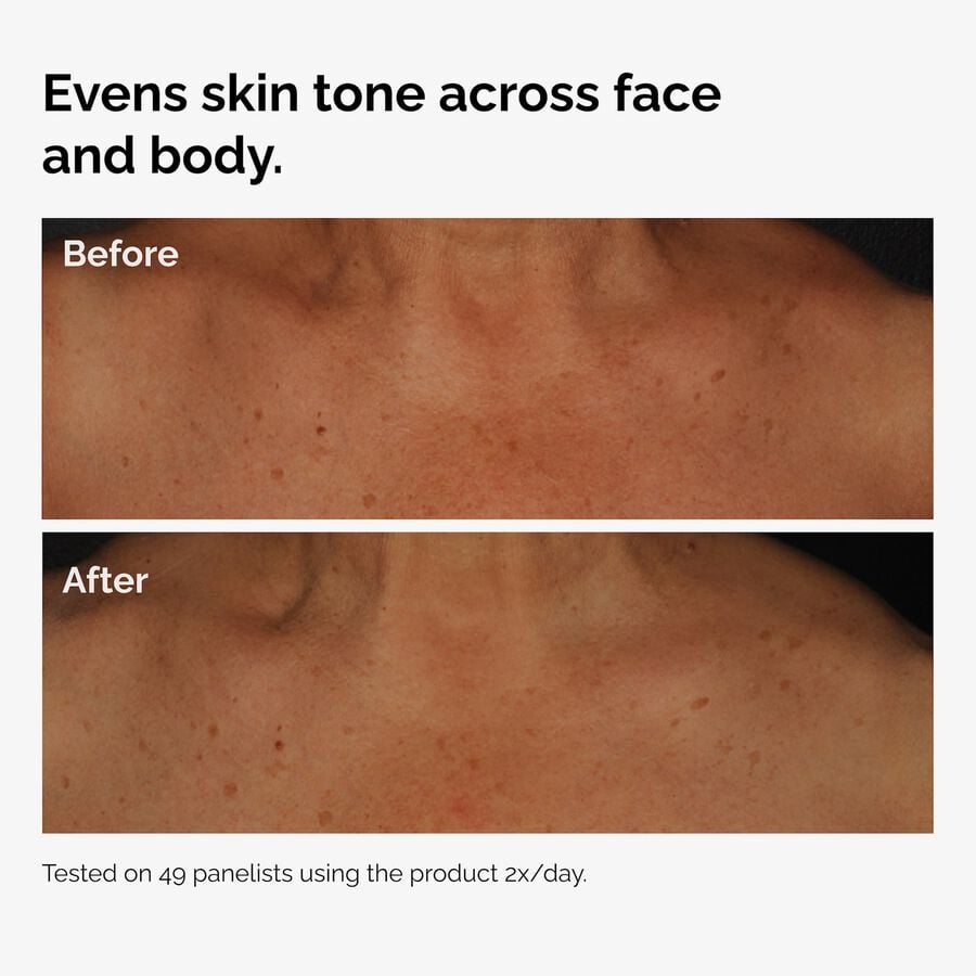 the-body-care-collection-d3 ord-niacinamide-face-body-serum-before-after-even-tone-graphic.jpg