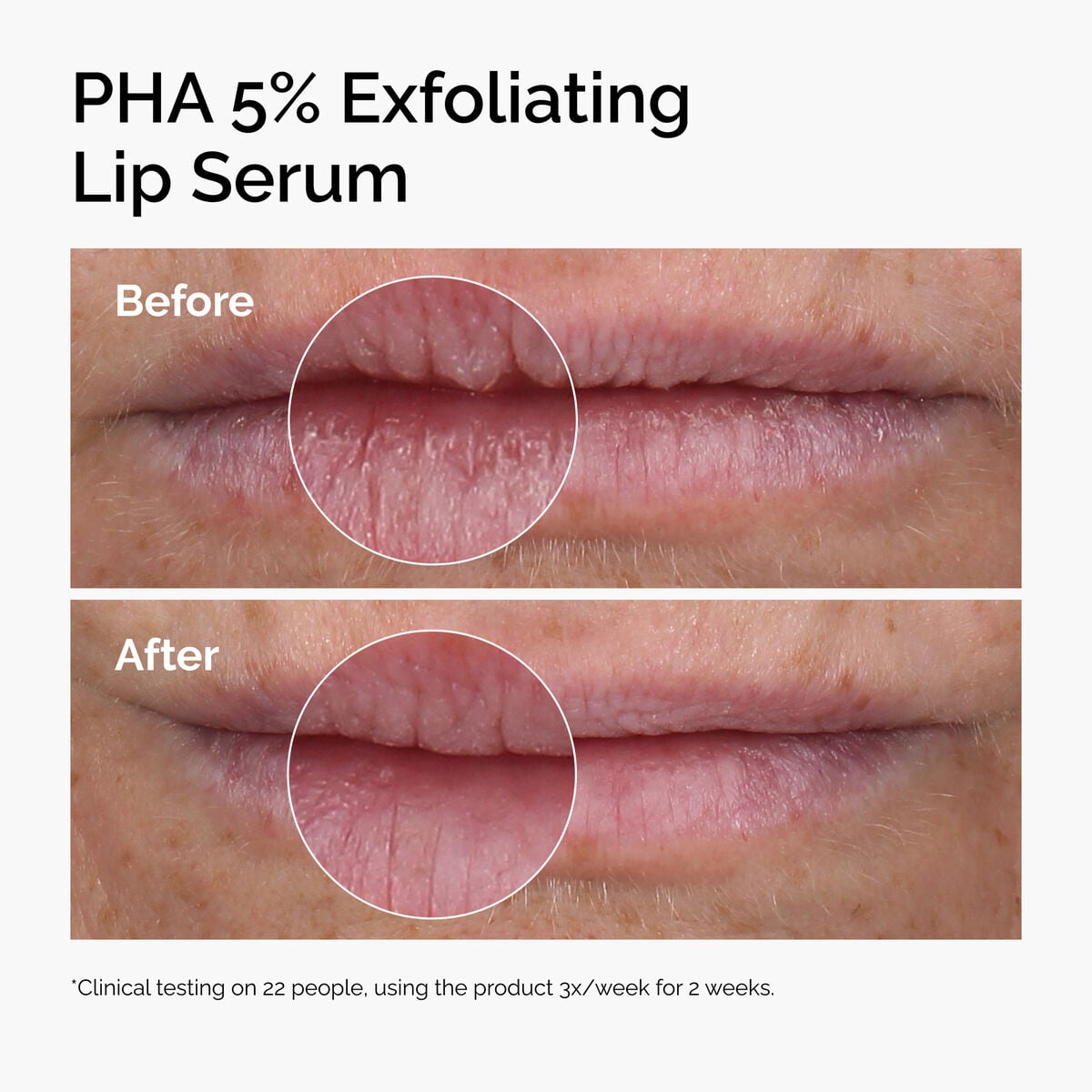 pha-5-exfoliating-lip-serum-o4 ord-pha-5pct-lip-exfoliating-serum-before-after.jpg